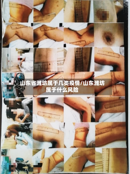 山东省潍坊属于几类疫情/山东潍坊属于什么风险-第1张图片